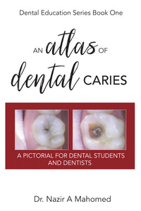 An Atlas of Dental Caries